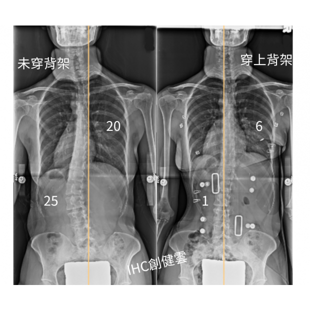 33歲成女性 S彎.png