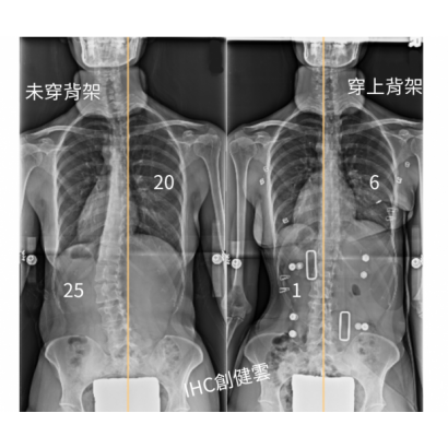 33歲成女性 S彎.png